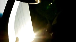 Ռիքի Ուայթի ռենտգենյան տեսահոլովակը, թե ինչպես է դեմքը խեղդվում ավազակային հարձակման ժամանակ